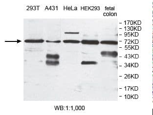 EPM2AIP1 Antibody (aa438-579)