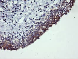 PIK3C2B Antibody (clone OTI2G3)