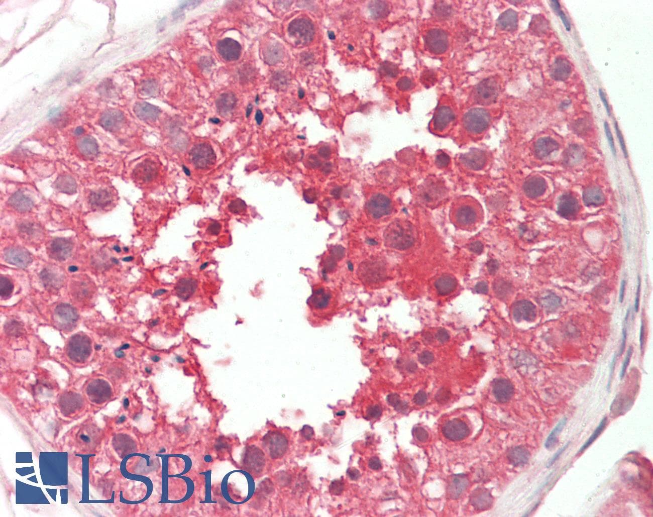 IHC-plus™ SPAG9 Antibody (aa775-825)