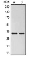 ELOVL6 Antibody (Internal)
