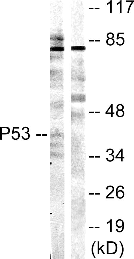 IHC-plus™ TP53 / p53 Antibody (aa10-59)