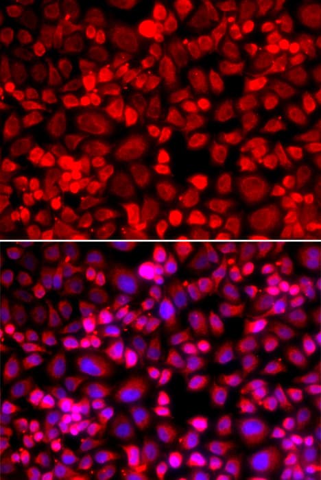 Anillin Antibody