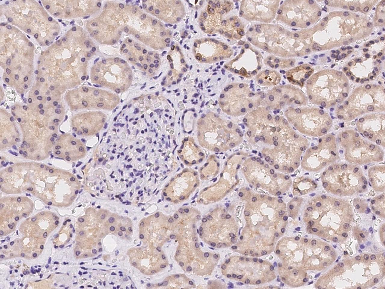 GLMN Antibody
