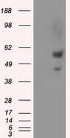 Monoclonal Mouse anti-Human NPR3 Antibody (clone OTI11B6, IHC, IF, WB)