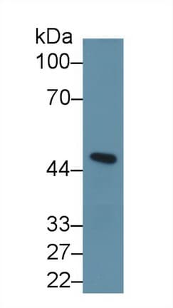 INHBA / Inhibin Beta A Antibody (aa311-426)