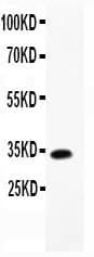CCL13 / MCP4 Antibody (aa24-98)