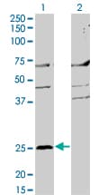 Monoclonal Mouse anti-Human MS4A2 / FCERI Antibody (clone 3B1, WB)