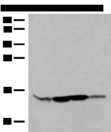 RPP14 Antibody