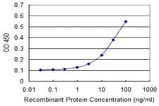 GLS / Glutaminase Antibody (clone 5C4)