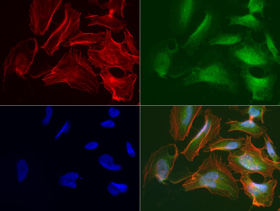 R1 / RRM1 Antibody (aa541-792, clone UMAB165, Carrier-free)