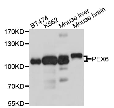 PEX6 Antibody