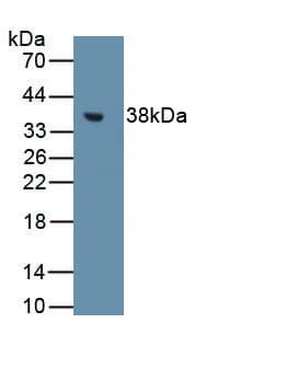 MT1E Antibody (Biotin)