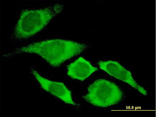 CDKN1A / WAF1 / p21 Antibody (clone 2F1)