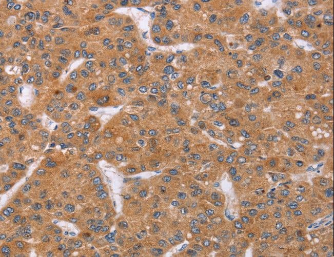 Polyclonal Rabbit anti-Human PPP2R3C Antibody (IHC)