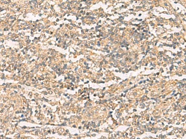 NQO2 Antibody