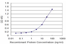 CD20 Antibody (aa1-298, clone 4F11)