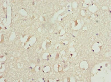 PITRM1 / MP1 Antibody