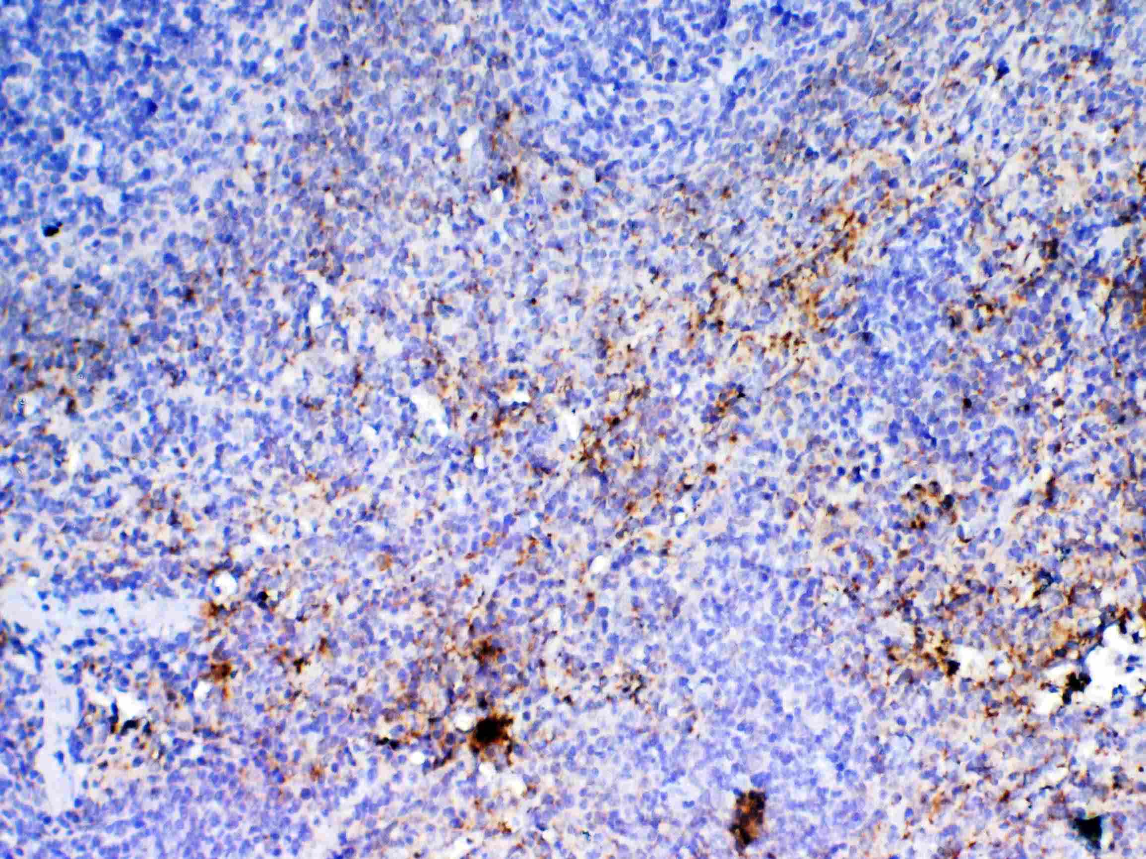 CXCL4 / PF4 Antibody