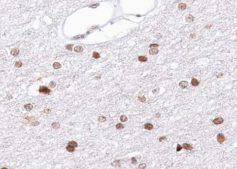 BRCA1 Antibody