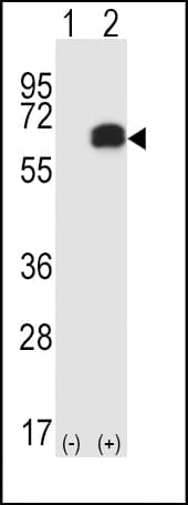 RICK / RIP2 Antibody (aa458-488)