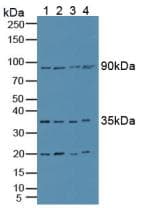CCS Antibody (aa23-269, Biotin)