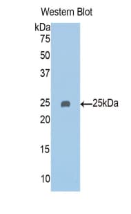 PAPPA2 / Pappalysin 2 Antibody (aa888-1093)