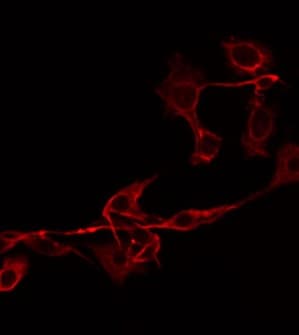 Polyclonal Rabbit anti-Human IL18BP Antibody (IF, WB)
