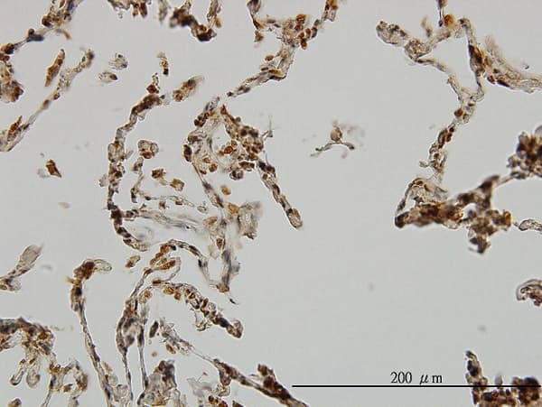 E6AP / UBE3A Antibody (clone 2F6)