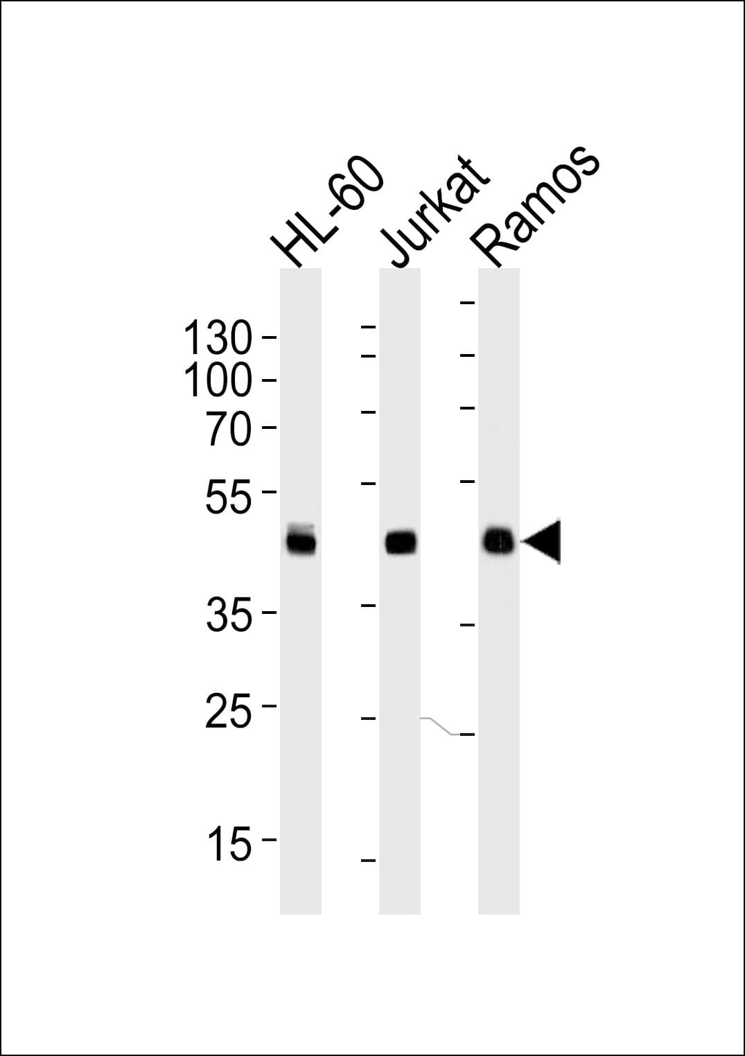 HLA-B Antibody (aa62-90)