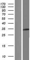 CECR1 Protein (Over-Expression Lysate Myc-DDK (Flag))