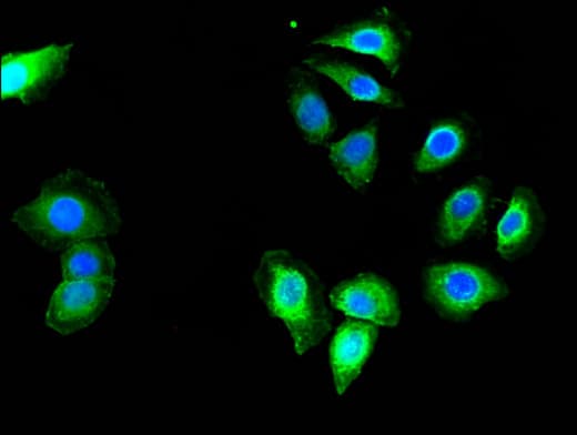 Polyclonal Rabbit anti-Human MED23 / SUR2 Antibody (IHC, IF)