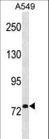 R1 / RRM1 Antibody (aa71-100)