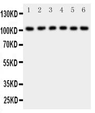 NFKB1 / NF-Kappa-B Antibody (aa778-797)