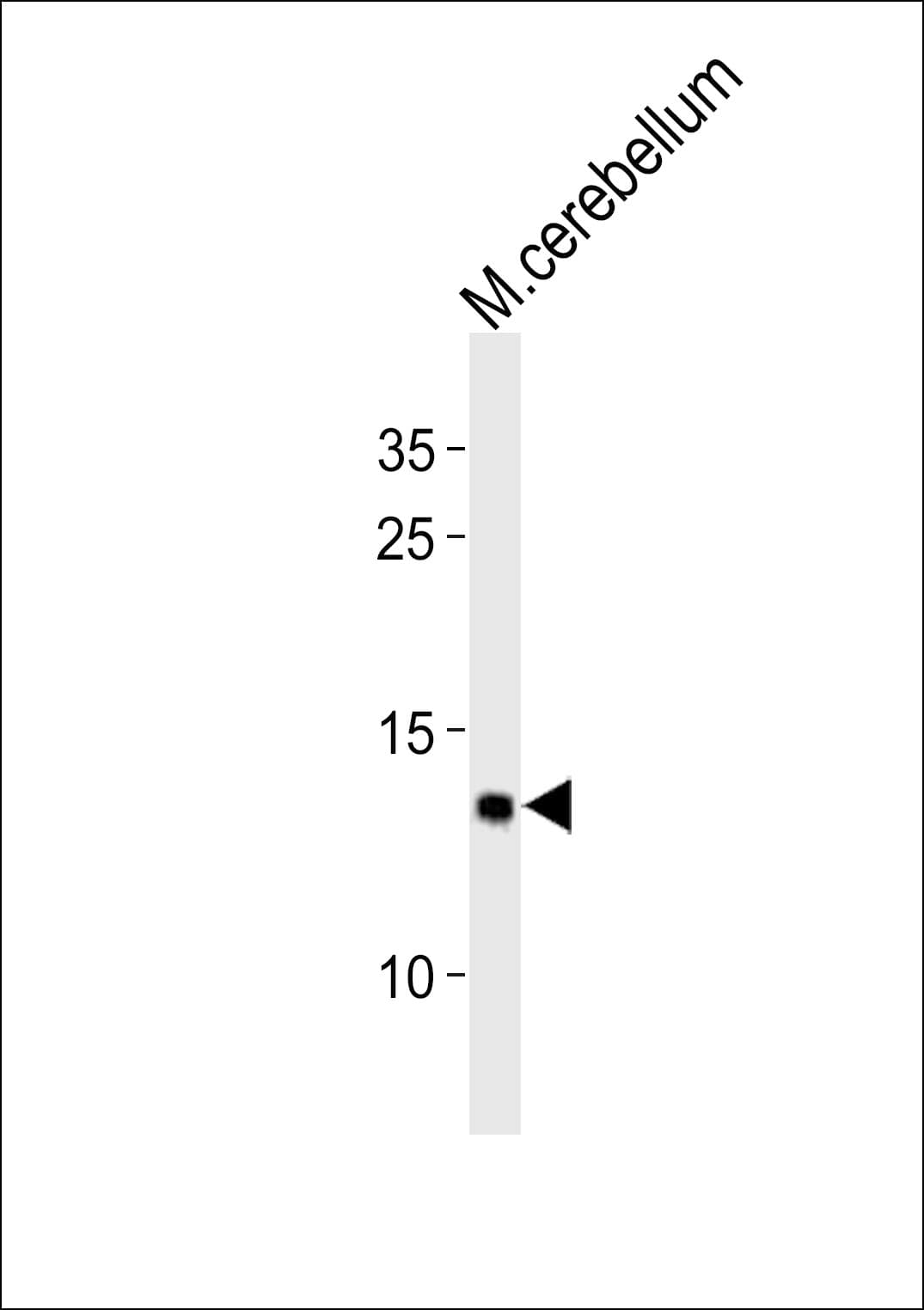 EIF1 Antibody (aa100-133)