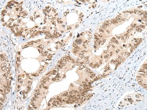 ZNF83 / HPF1 Antibody