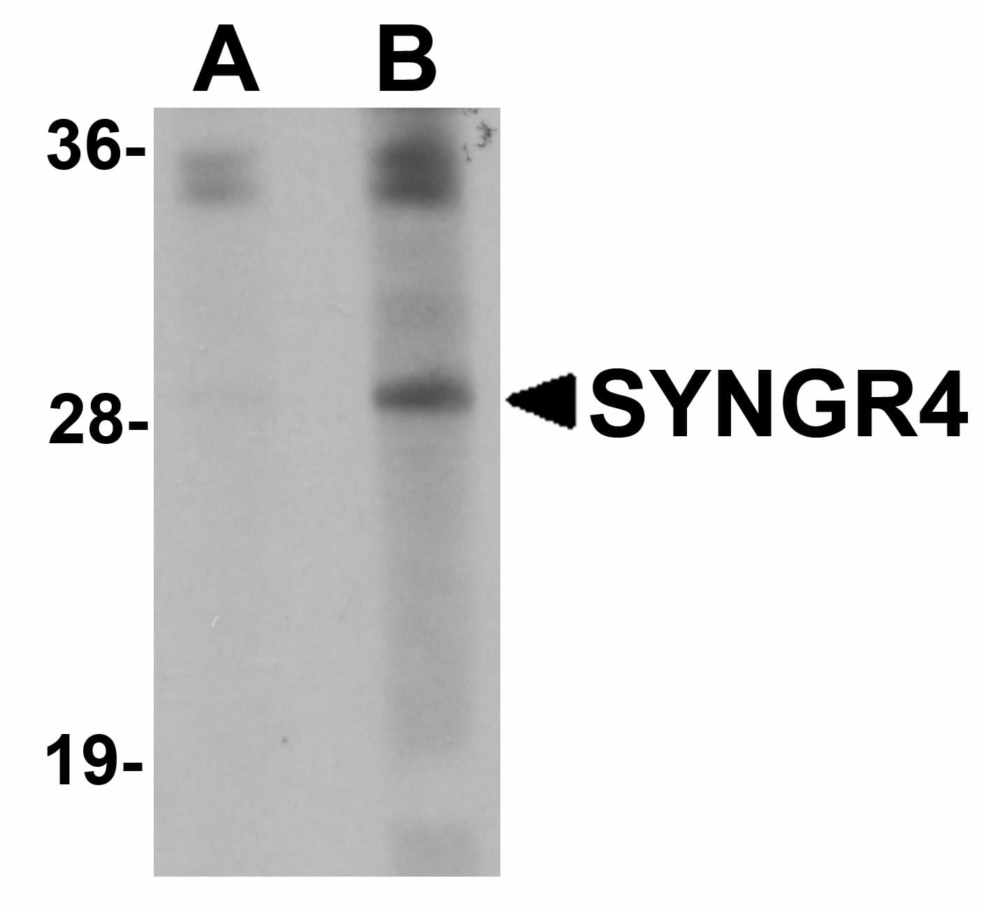 Polyclonal Rabbit anti-Human SYNGR4 / Synaptogyrin 4 Antibody (IHC, IF, WB)
