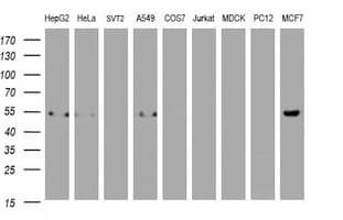 Monoclonal Mouse anti-Human Selenium Binding Protein 1 Antibody (clone OTI3A3, IHC, WB)