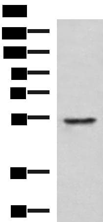 Polyclonal Rabbit anti-Human TUBD1 / Tubulin Delta Antibody (IHC, WB)
