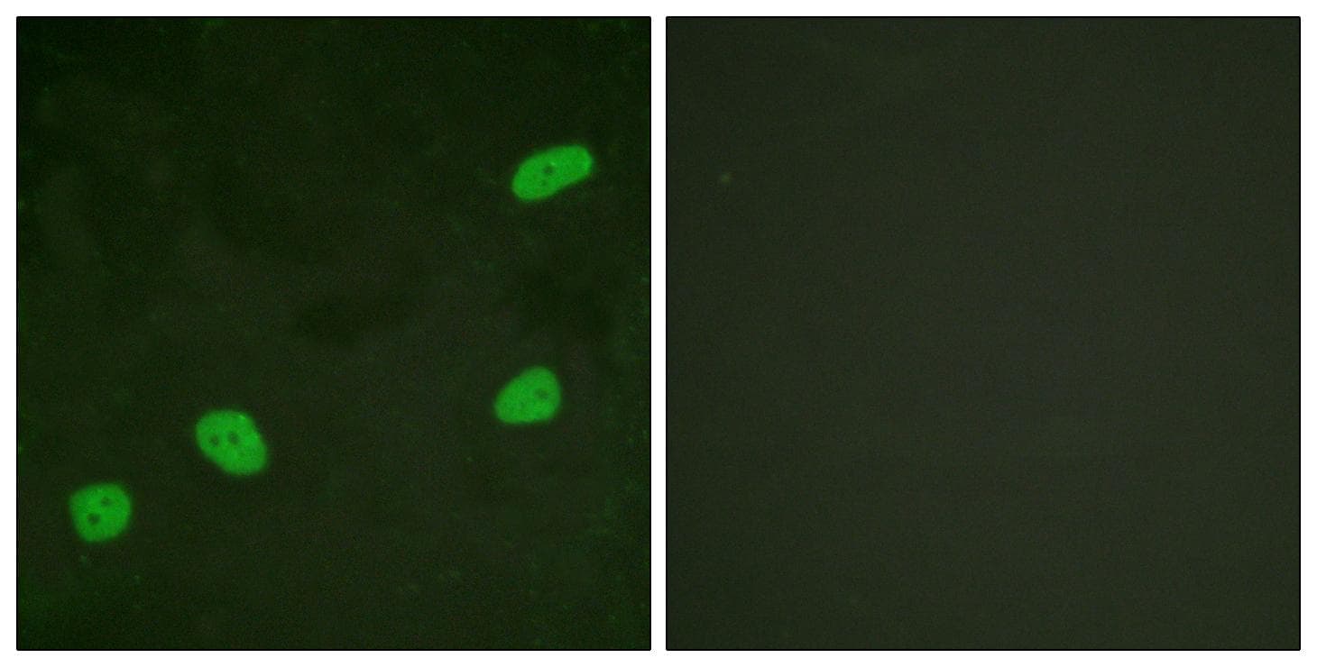 ATRIP Antibody (p68/72)