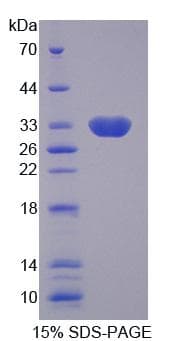 Human SLC25A13 / CITRIN Protein (Recombinant His, N-Terminal)