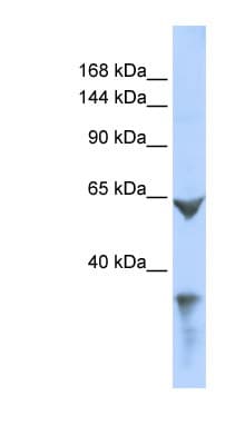 Polyclonal Rabbit anti-Human LRP1 / CD91 Antibody (aa211-260, WB)