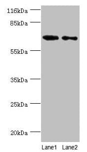 GALNT14 Antibody (aa1-552)