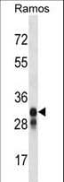 Polyclonal Rabbit anti-Human HLA-DMB Antibody (aa104-133, WB)