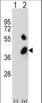 Polyclonal Rabbit anti-Human BCKDHB Antibody (aa41-70, IHC, IF, WB)