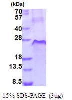 Human TNFRSF1A / TNFR1 Protein (Recombinant His)