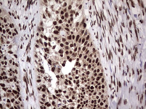 C14orf166 Antibody (clone OTI1B2)