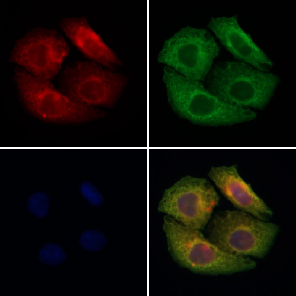 MMP24 Antibody