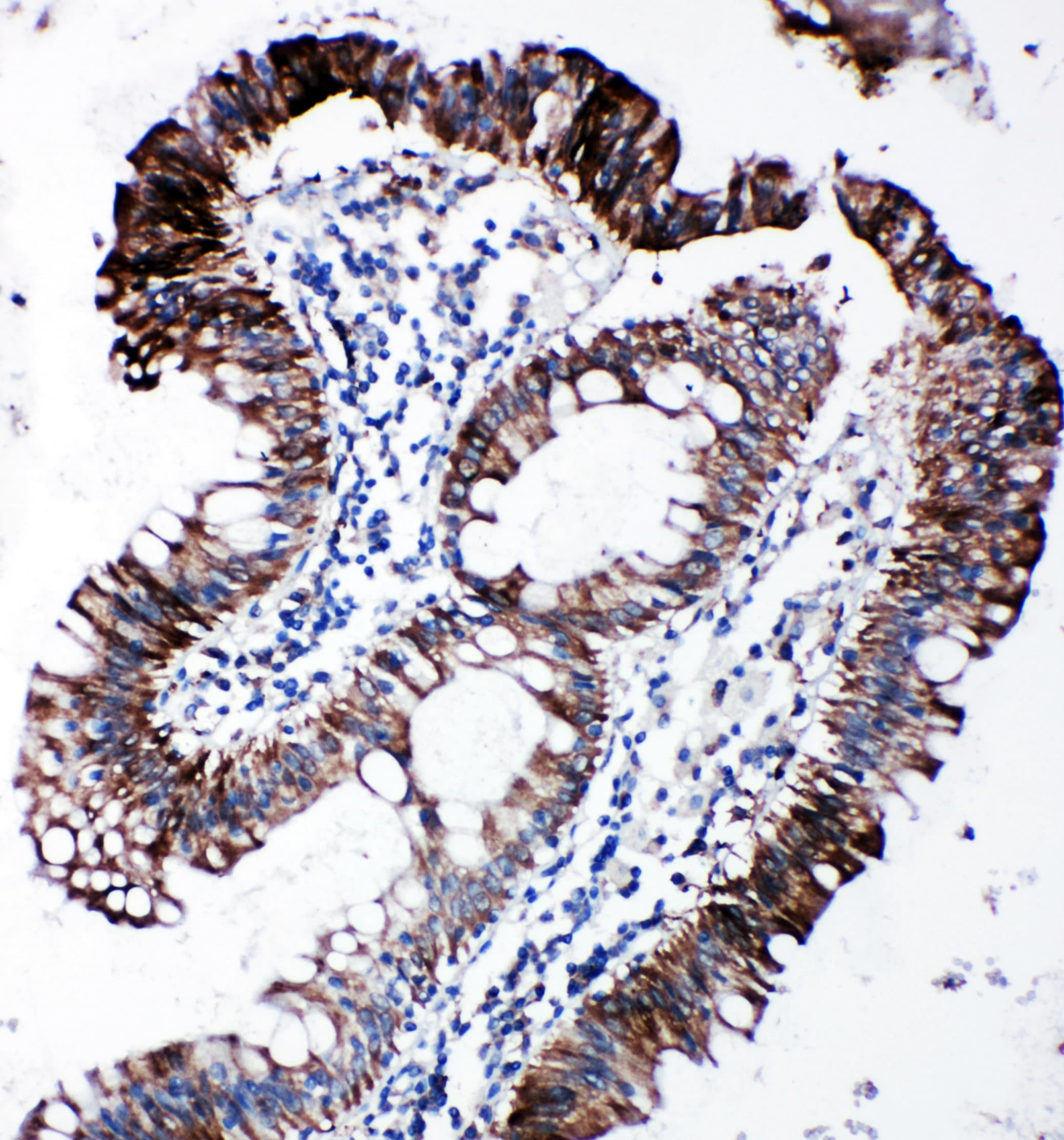 EIF2S1 Antibody (aa123-137)