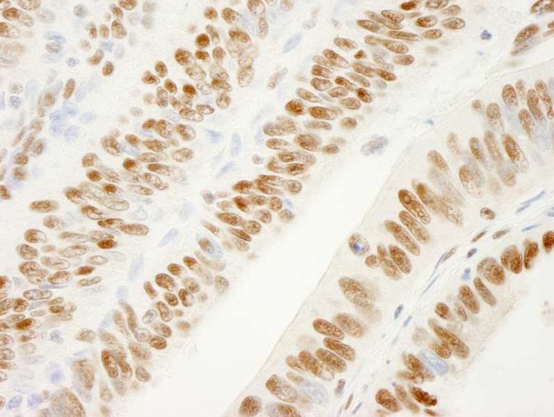 KHDRBS1 / SAM68 Antibody (aa1-50)