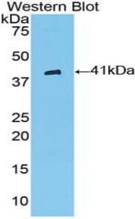 AKT1 Antibody (aa122-443, PE)